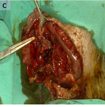 Diagnostic efficacy of serum procalcitonin, IL-6, IL-2, and D-dimer levels in an experimental acute appendicitis model