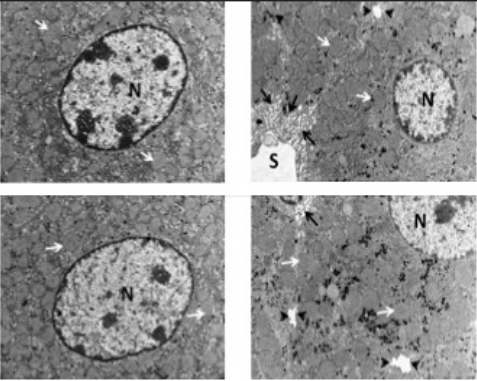 A bioactive product lipoxin A4 attenuates liver fibrosis in an experimental model by regulating immune response and modulating the expression of regeneration genes