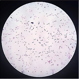 Anti-colon cancer activity of Bifidobacterium metabolites on colon cancer cell line SW742