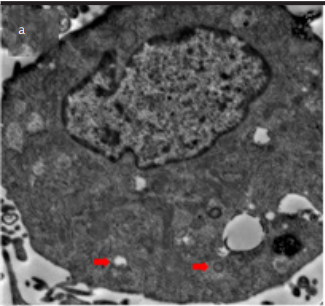 Frizzled-2 small interfering RNA protects hepatic BRL-3A cells against Hypoxia / Reoxygenation via modulation of autophagy